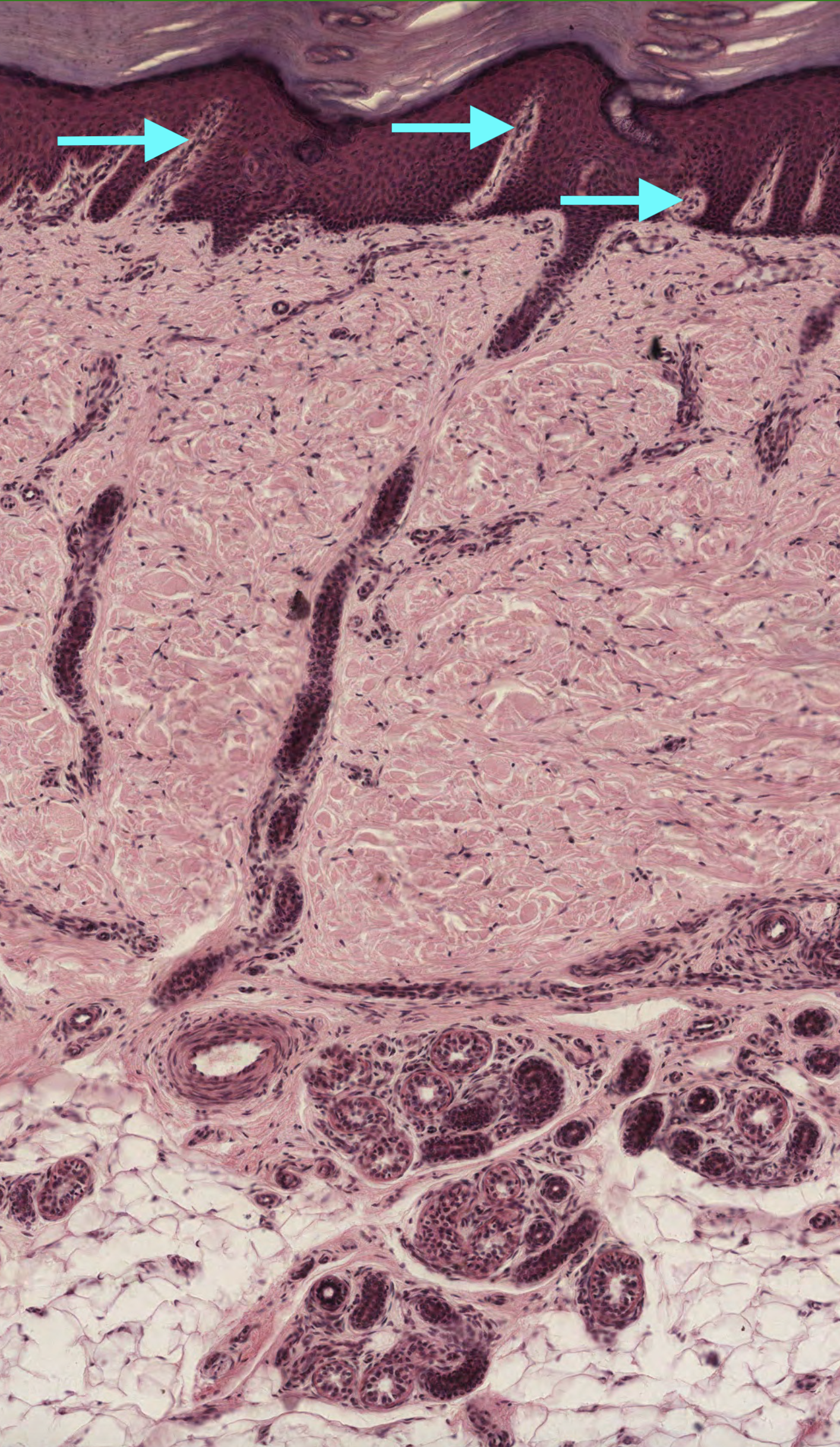 Dermal Papillae Histology