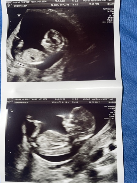 12 week scan - boy/girl? | Mumsnet