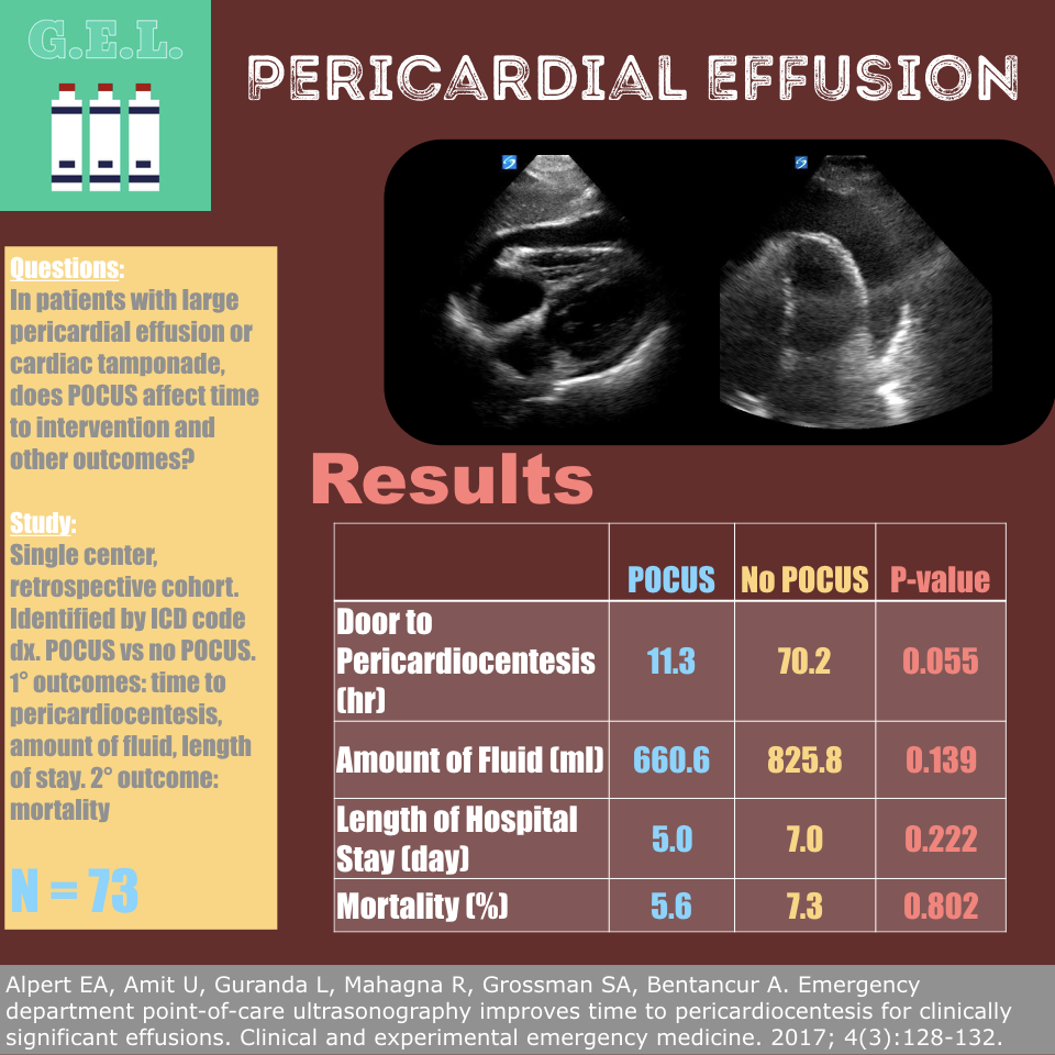 Pericardial Tamponade Ultrasound