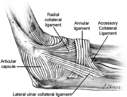 Radial Head Fractures - Trauma - Orthobullets