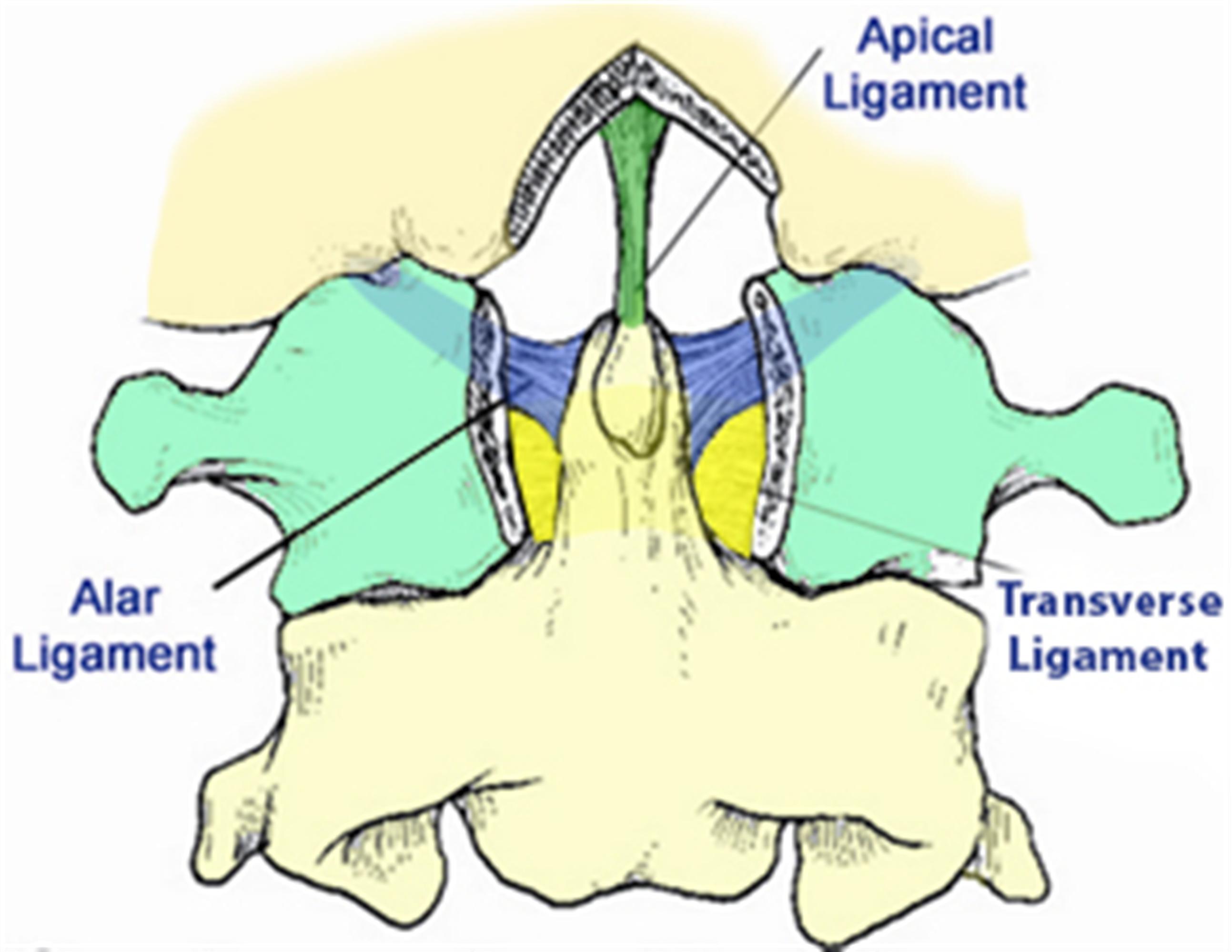 Occipital Condyle Fractures - Spine - Orthobullets