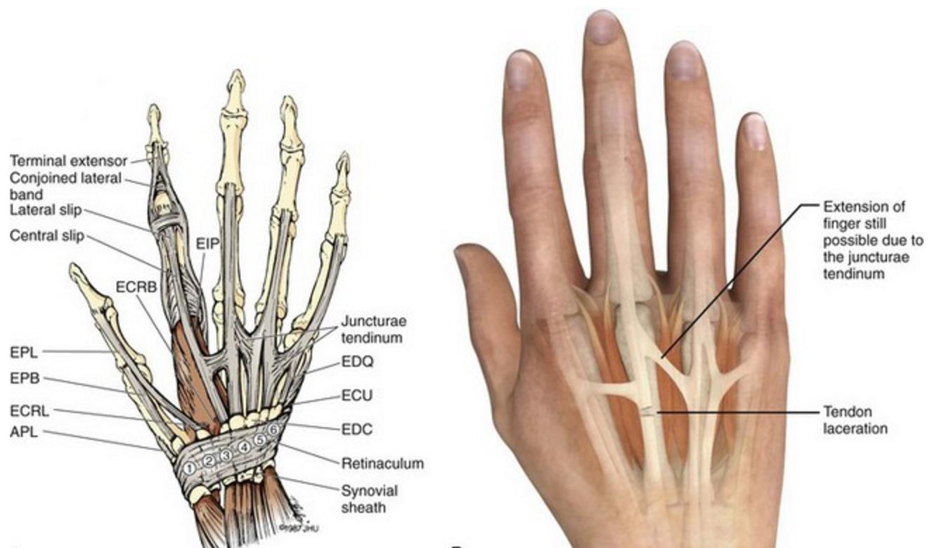 Wrist Extensor Retinaculum Injury