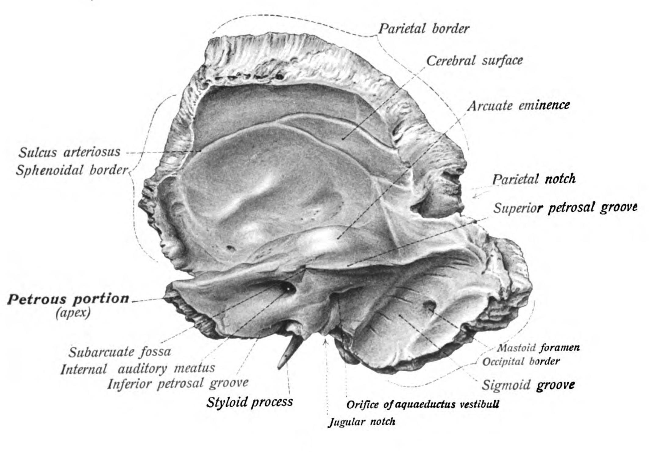 Temporal Bone