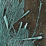 July 28: Electron micrograph showing exaggerated filopodia with club-like shape induced by formin mDia2 in cultured cells.