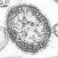 transmission electron micrograph (TEM)