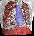 Mediastinum