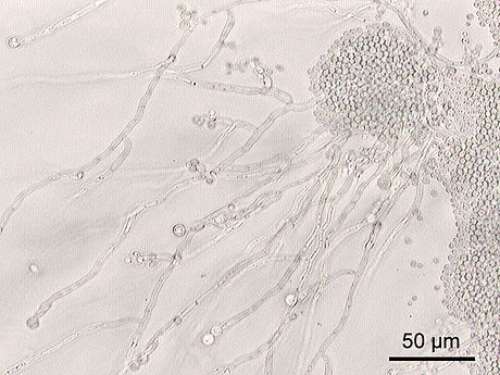 Candida (fungus)