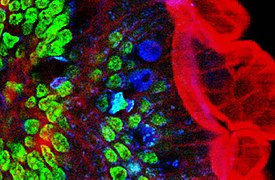 February 26: Two-photon excitation microscopy of mouse intestine.