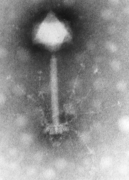 May 18: Transmission Electron Microscopy of the Synechococcus Phage S-PM2.