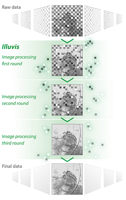 Illuvis noise reduction technology