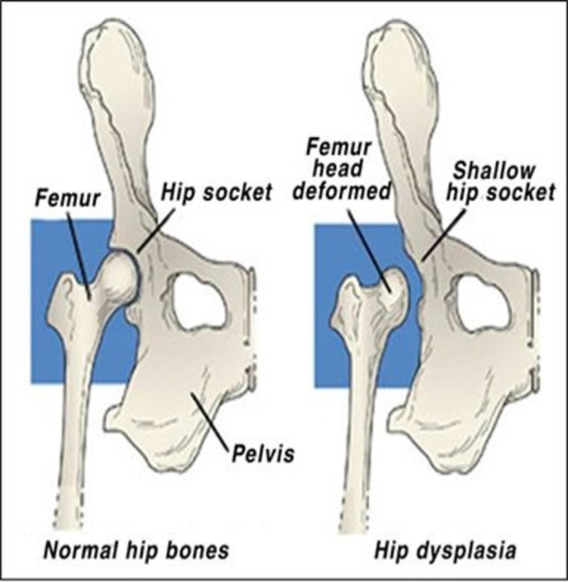 A Simple Guide To Hip Dysplasia In Dogs Pethelpful