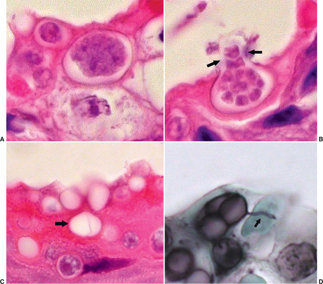 Chytridiomycota Zoospore