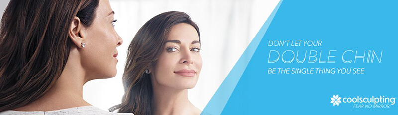 Coolsculpting your Double Chin