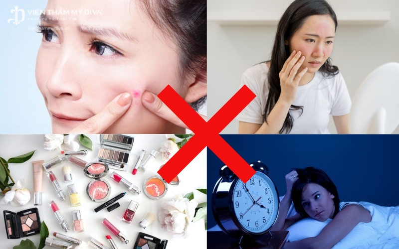 Điều Trị Sẹo: Bí Kíp Từ Chuyên Gia Da Liễu Giúp Bạn Lấy Lại Làn Da Mịn Màng 20