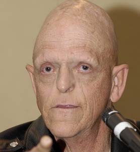 Michael Berryman