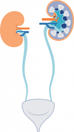 kidney-diagram - Acute Kidney Injury