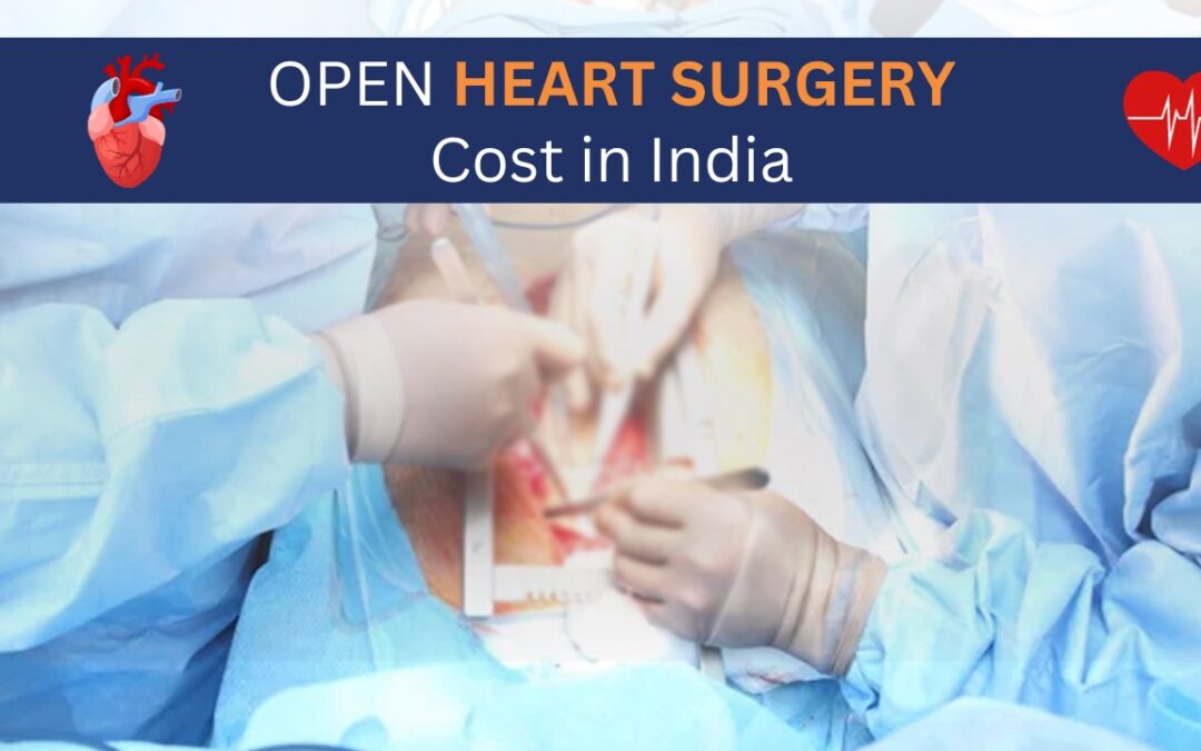 Open Heart Surgery Cost in India