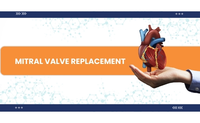 Mitral Valve Replacement cost