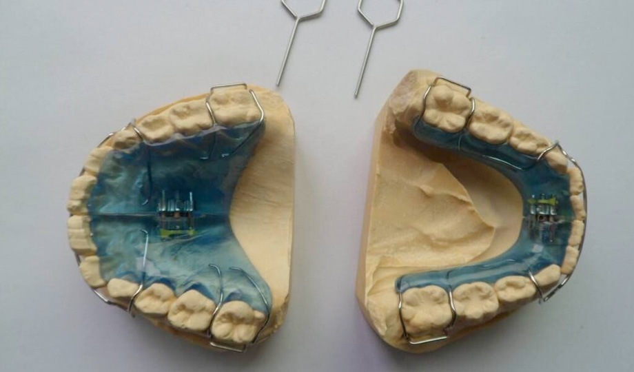 Palatal Expansion Darien & Norwalk, CT