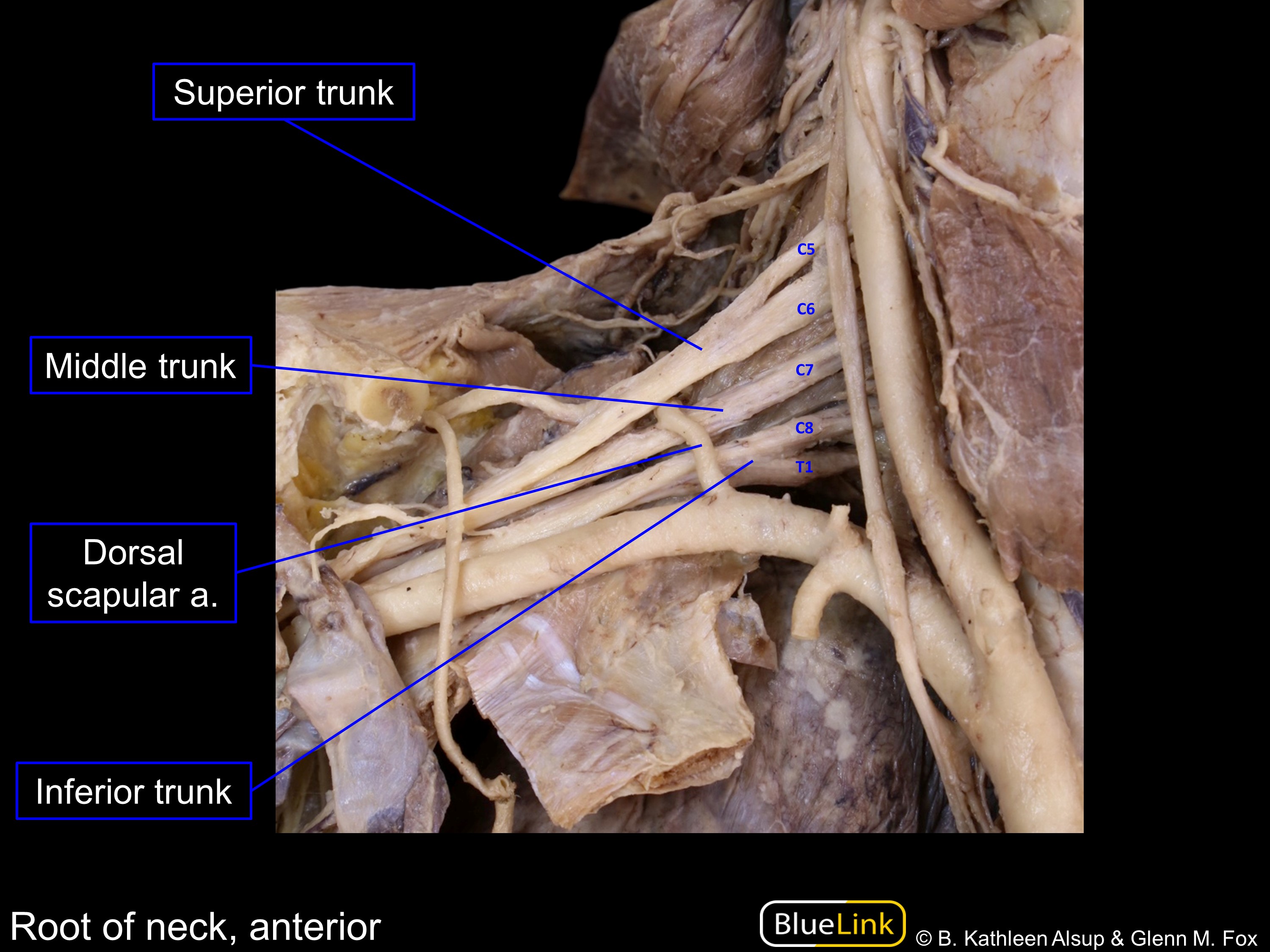 Dorsal Scapular Nerve Cadaver