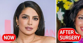 How a Botched Plastic Surgery in the 2000s Almost Ruined Priyanka Chopra’s Life