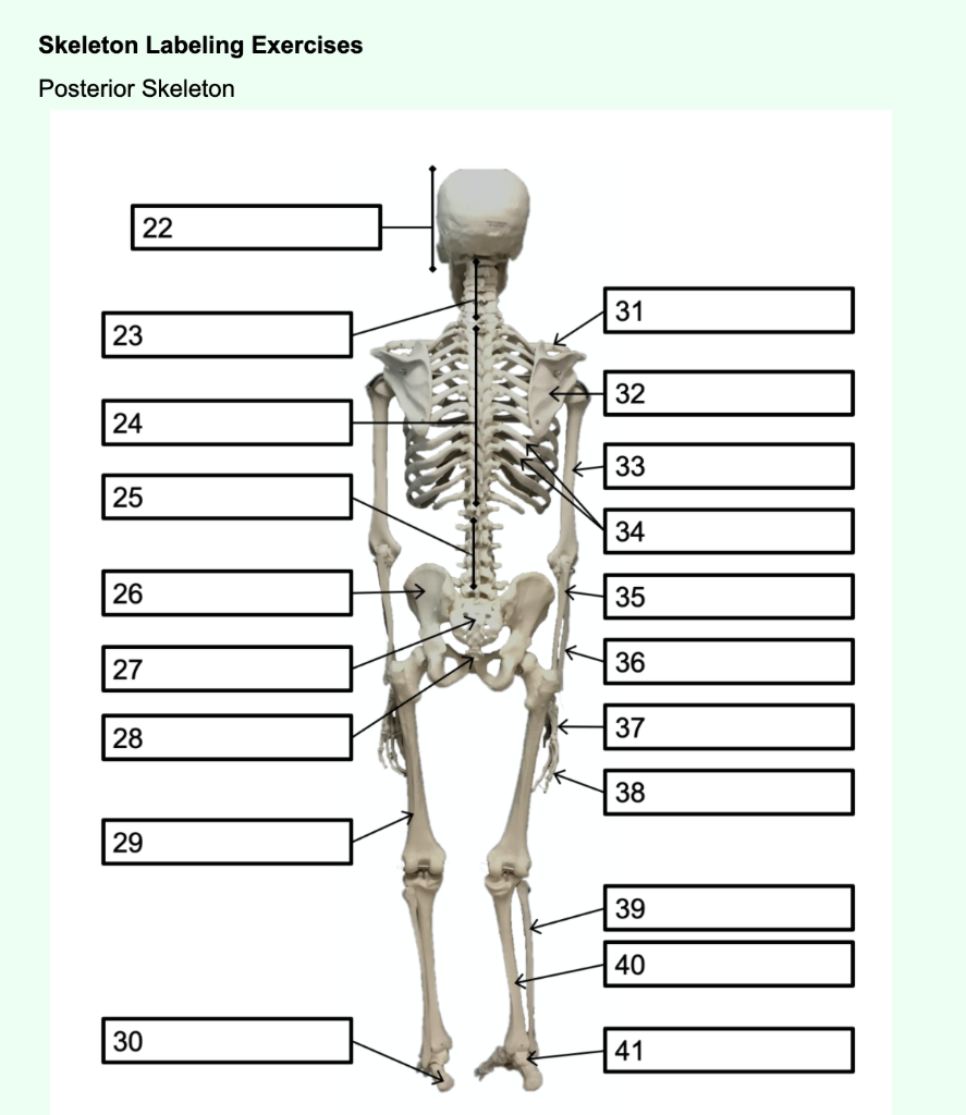 Solved Bone Names Axial Skeleton Bone Names Skull Bones | Chegg.com ...