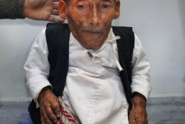 Editor in Chief of Guinness World Records Craig Glanday, right, and Dr. Kashila Pradhan, left, officially measure Nepal's Chandra Bahadur Dangi, 72, who says he's only 22 inches (56 centimeters) tall, at the CIWEC clinic in Katmandu, Nepal, Sunday, Feb. 26, 2012. Guinness World Records officials measured Dangi who hopes to be named the world's shortest man later Sunday. Dangi is hoping to snatch the title of the world's shortest man from Junrey Balawing of the Philippines, who is 23.5 inches (60 centimeters) tall. (AP Photo/Niranjan Shrestha)