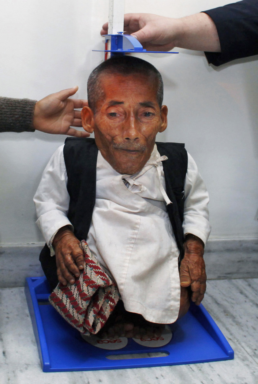 Editor in Chief of Guinness World Records Craig Glanday, right, and Dr. Kashila Pradhan, left, officially measure Nepal's Chandra Bahadur Dangi, 72, who says he's only 22 inches (56 centimeters) tall, at the CIWEC clinic in Katmandu, Nepal, Sunday, Feb. 26, 2012. Guinness World Records officials measured Dangi who hopes to be named the world's shortest man later Sunday. Dangi is hoping to snatch the title of the world's shortest man from Junrey Balawing of the Philippines, who is 23.5 inches (60 centimeters) tall. (AP Photo/Niranjan Shrestha)