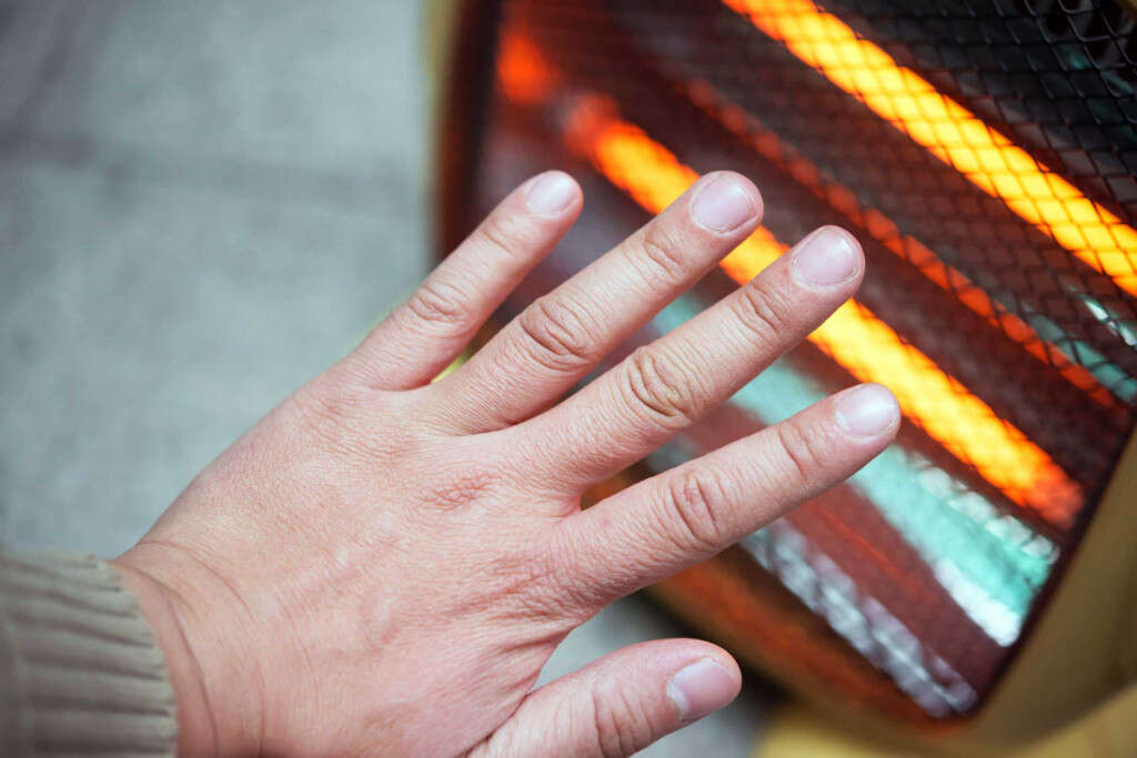 Raynaud's Syndrome