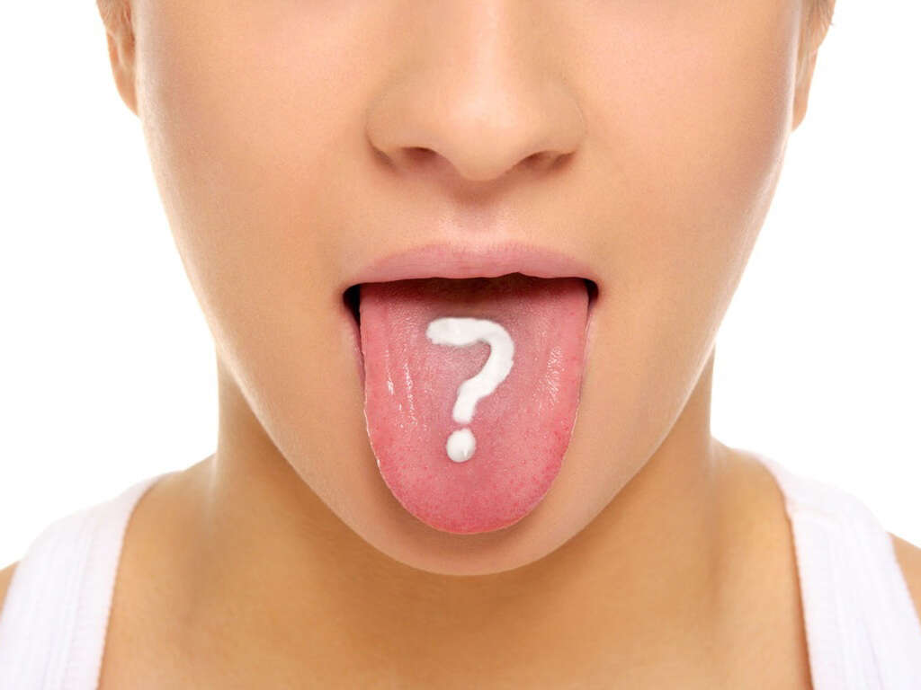 Tongue Cancer