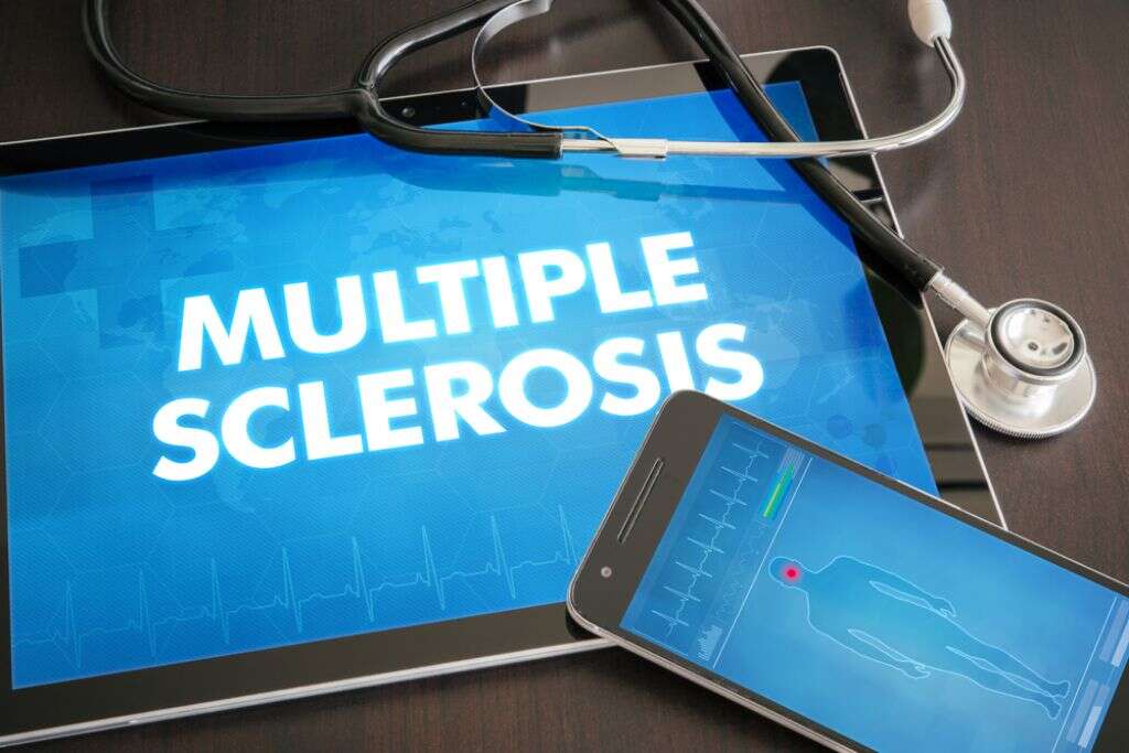 Multiple Sclerosis