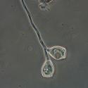 Stalked ciliate