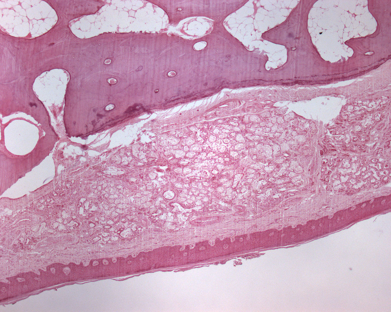 Hard Palate Histology