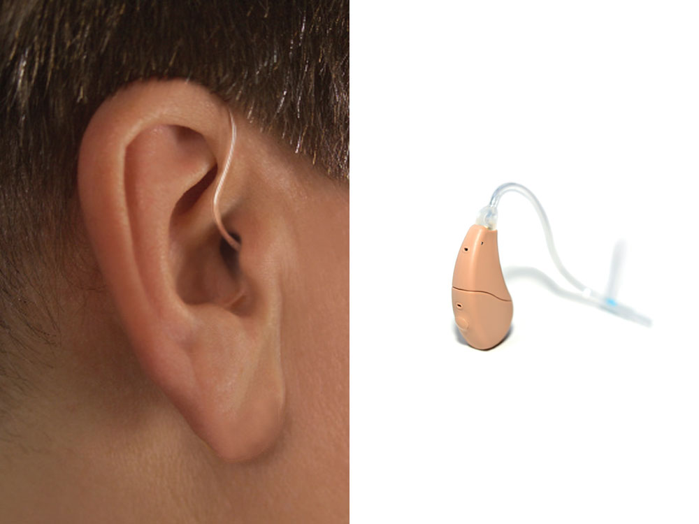 Open Fit Behind The Ear Hearing Aids