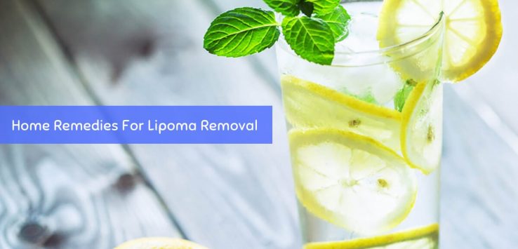 Lipoma removal _ Ayurvedum