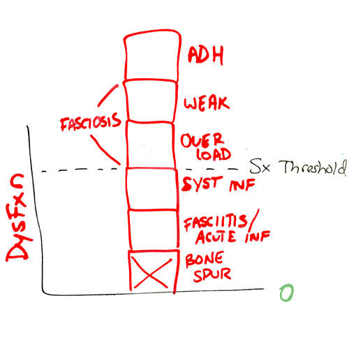 bone-spur-dysfunction-blocks