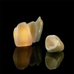 Cercon Zirconia Crowns