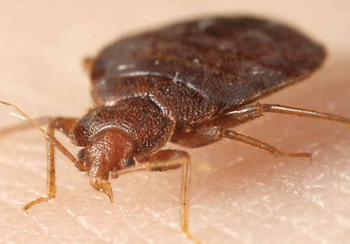 bed bug biting skin