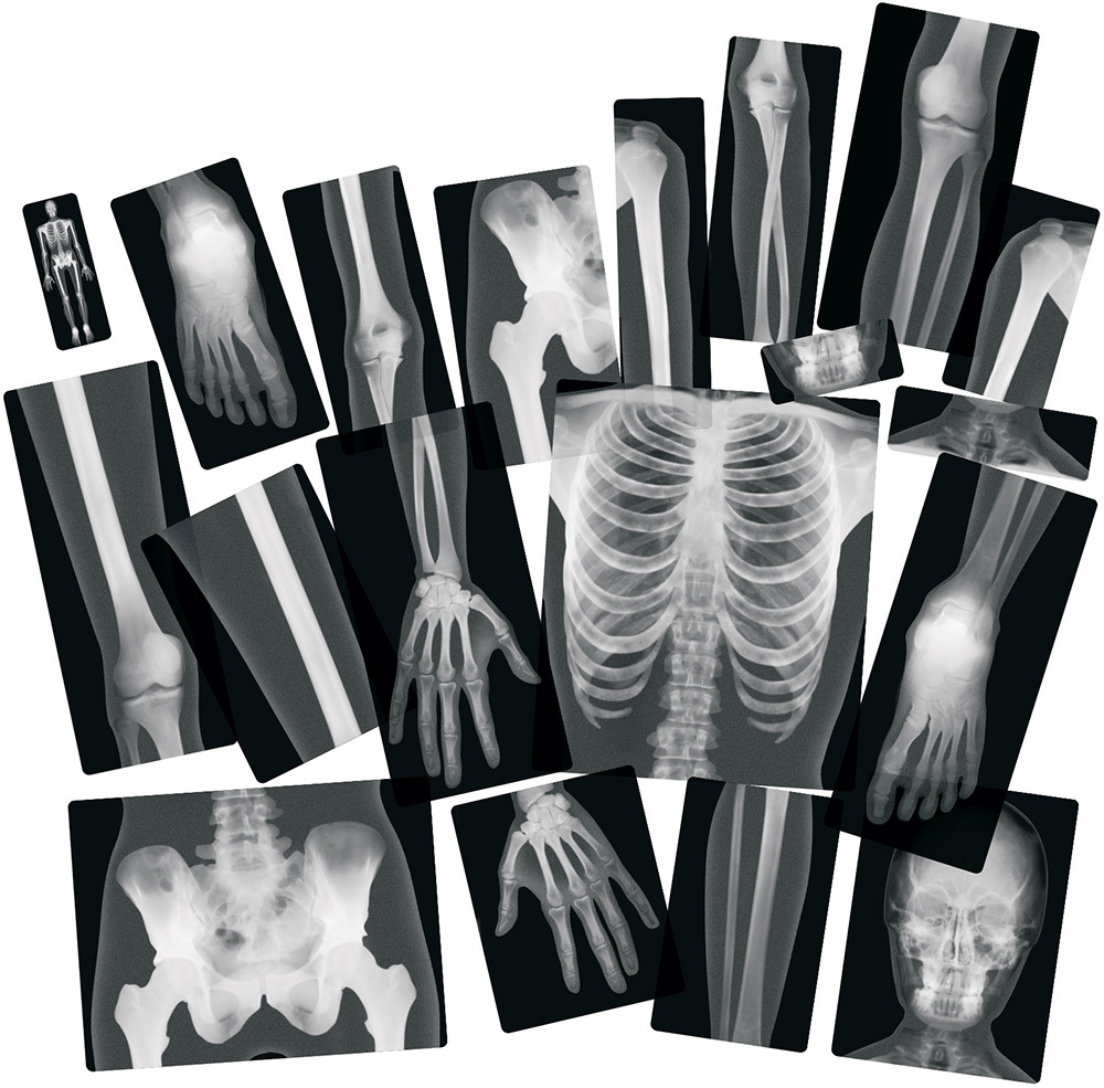 True To Life Human X-Rays - 18pcs