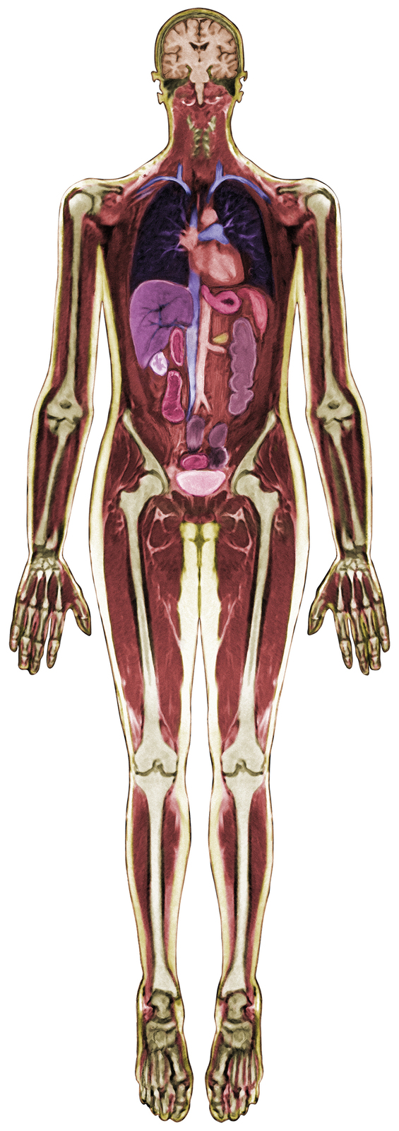 Look Inside Me MRI Scan - 18pcs