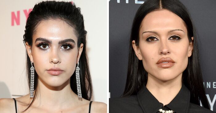 “Looked Better Before”: 17 Stars People Say Look Unrecognizable After Plastic Surgery