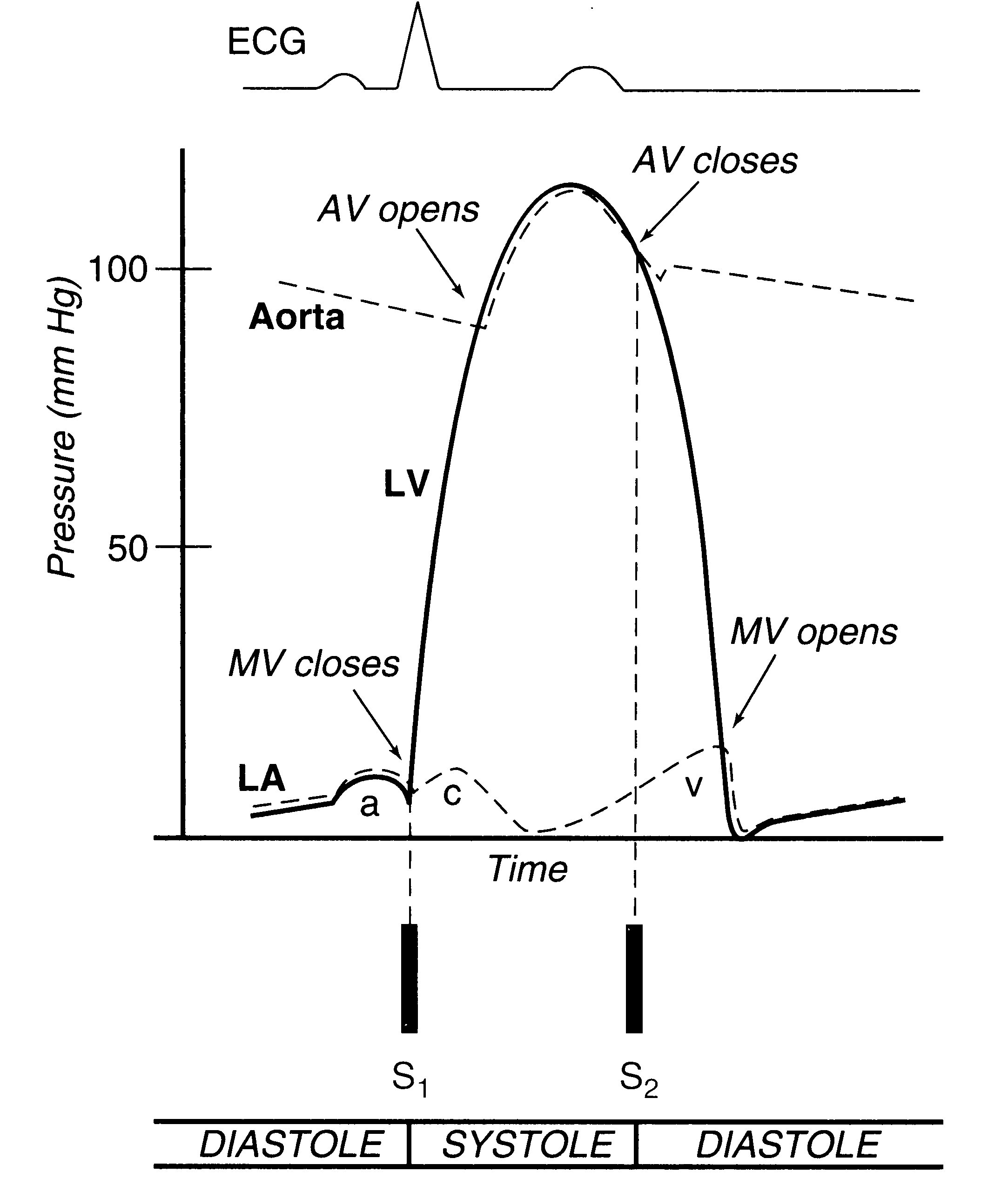 Cardiac Cycle Diagram Explained