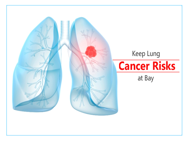 7 Symptoms Of Lung Cancer in Women You Need to Know | Cancer Healer ...