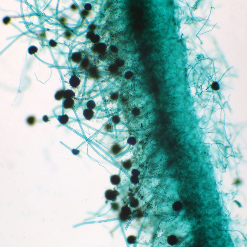 รายการ 90+ ภาพ aspergillus sp. ลักษณะ ใหม่ที่สุด – BuoiHoLo VTTN VN