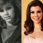 Heather Dubrow before and after Plastic Surgery