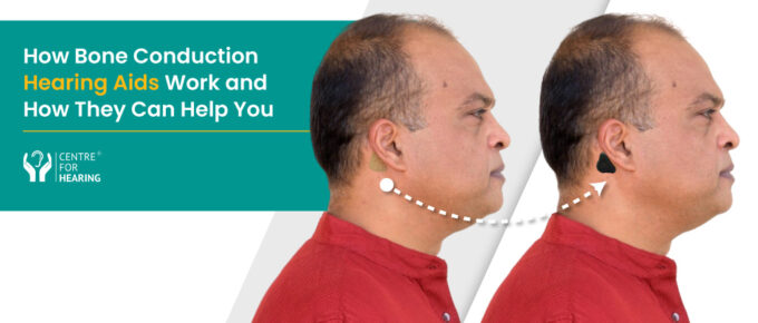 Bone Conduction Hearing Aids