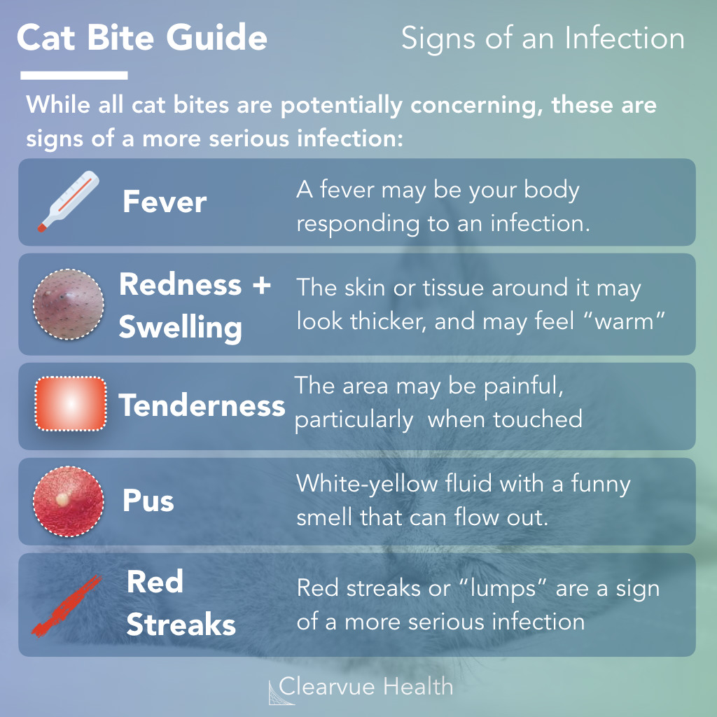 Are Cat Bites More Dangerous Than Dog Bites