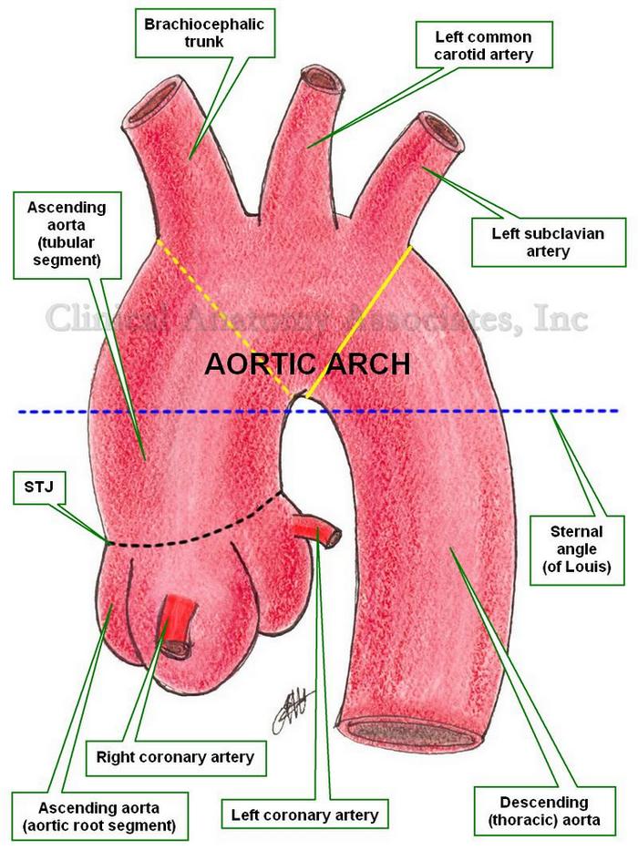 Instant Anatomy Thorax Vessels Arteries Ascending Aorta In 2022 ...