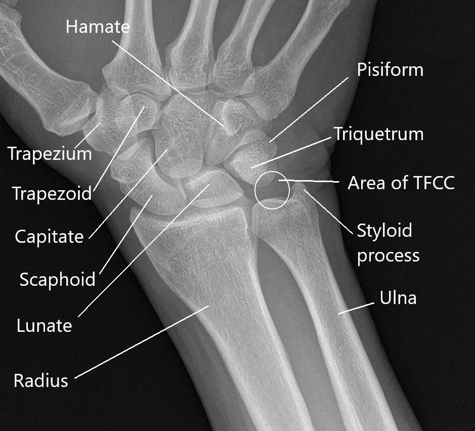 Top 93+ Pictures Normal X-ray Of Hand And Wrist Sharp 10/2023