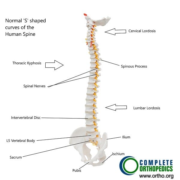 Flatback Syndrome - Complete Orthopedics | Multiple NY Locations